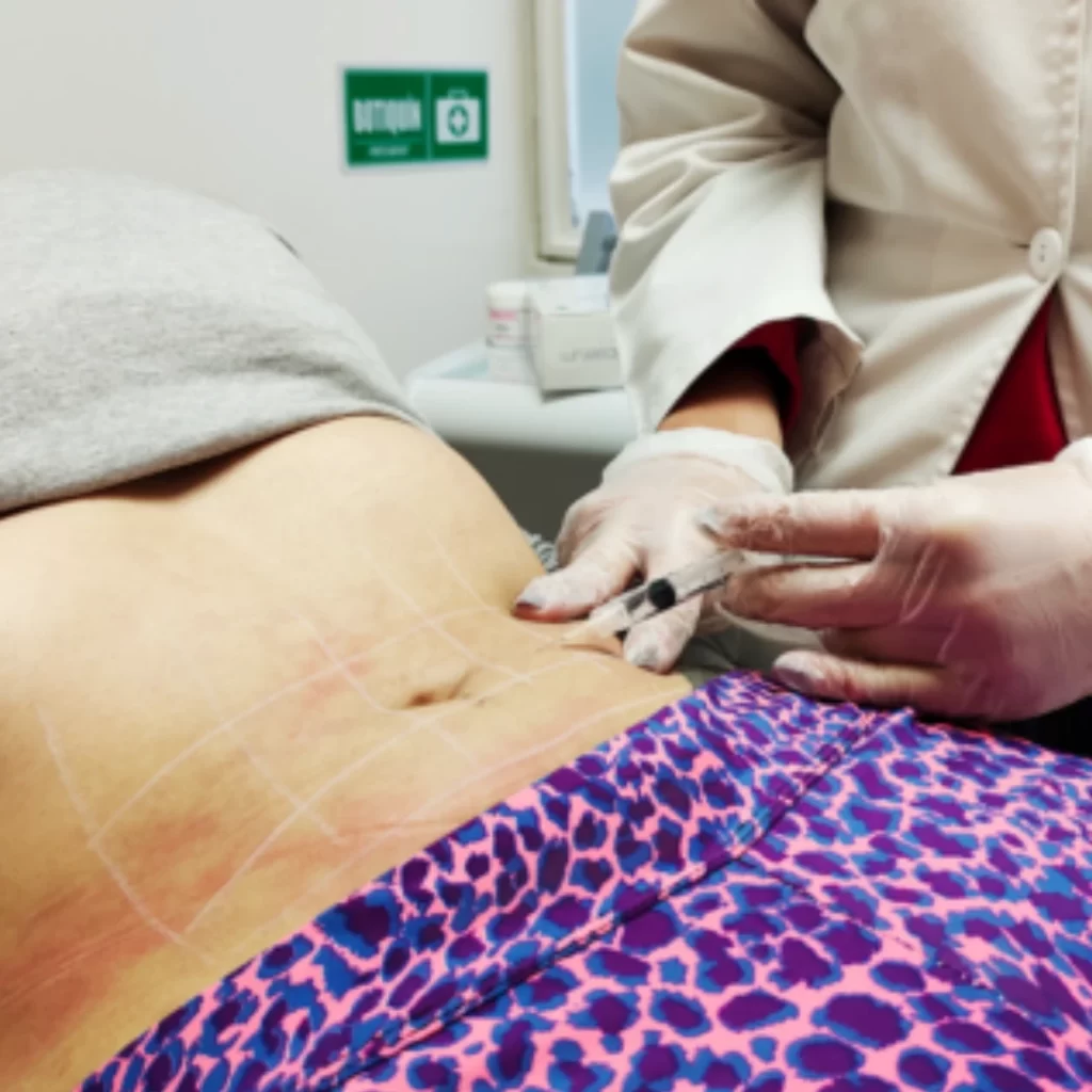 Mesoterapia corporal en Promoestetica - Procedimiento