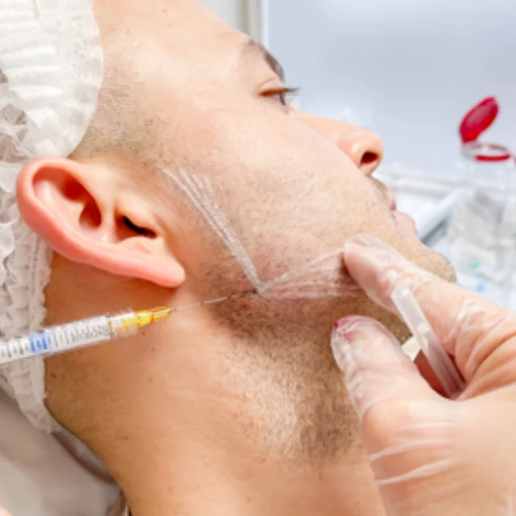 Permilamiento Facial en promoestetica - Procedimiento