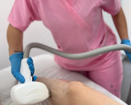 Depilacion-laser-en-promoestetica-aplicación 3