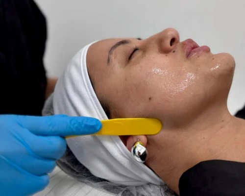Venus facial procedimiento en Promoestetica