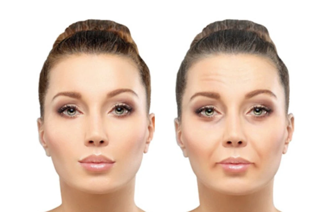 Blog de Promoestetica: paso del tiempo en la piel