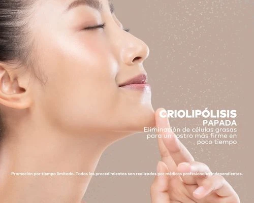 Criolipólisis en Papada